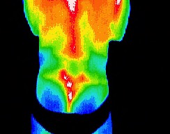 L gluteal pain (Swimmer's nemesis)