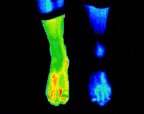 5- Left ankle fracture.jp2