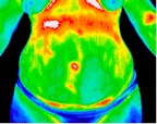 7- Right kidney infection.jp2