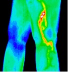 9- Phlebitis.jp2