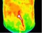 11- Hepatitis.jp2