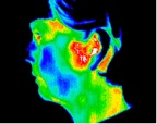 13- Temporomandibular joint disorder.jp2